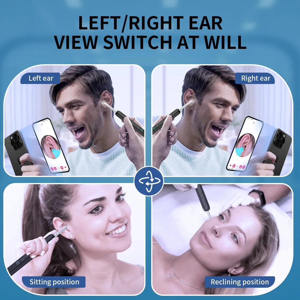 THE VIRAL KITTIE™ EAR SCOPE